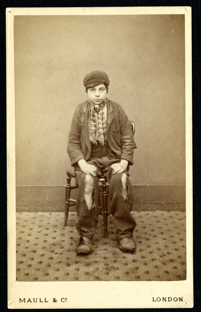 A white boy with dark hair of about age ten sits in a chair, his hands on his knees looking slightly off camera. He wears hat, jacket, neckerchief, and tatered pants.